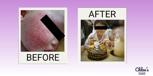 5 Reasons Why Prebiotics in Chloe’s Gelato Are a Game-Changer